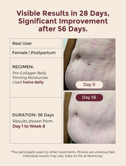 Momcozy Stretch Mark Prevention Cream for Pregnant Women, Travel Size Belly Moisturizer for Dry Skin, Peptides & Shea Butter, Maternity Care, 1.06 oz (30g)